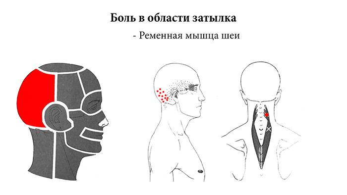 Болит затылок с правой и левой стороны головы: причины, лечение
