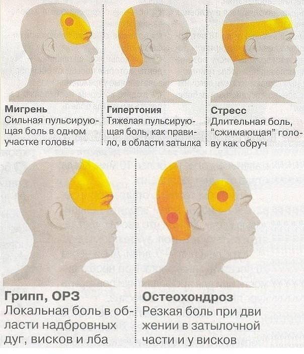 Болит затылок головы: причины боли, что делать с ней — медицинский портал doctop.ru