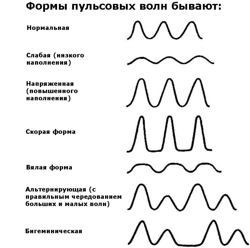 Основные характеристики артериального пульса схема