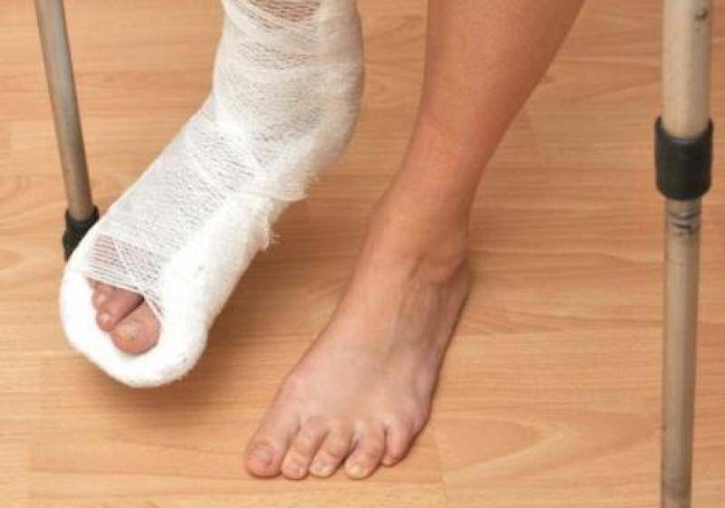 Сколько носить гипс при переломе пальца на ноге