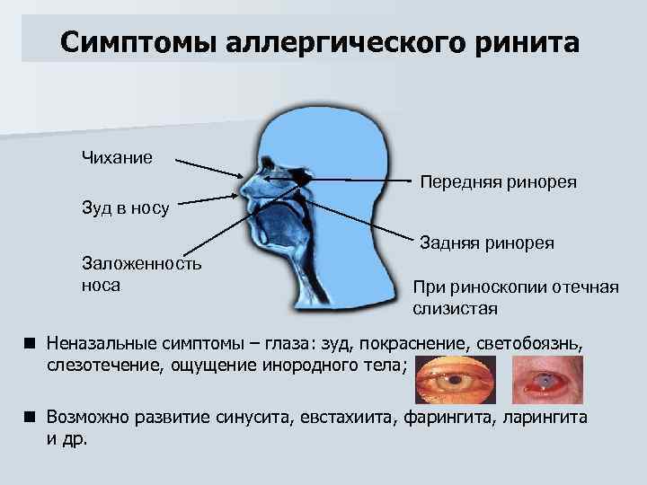 Психосоматика носового кровотечения