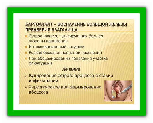 Бартолинит — опасное воспаление женских половых органов