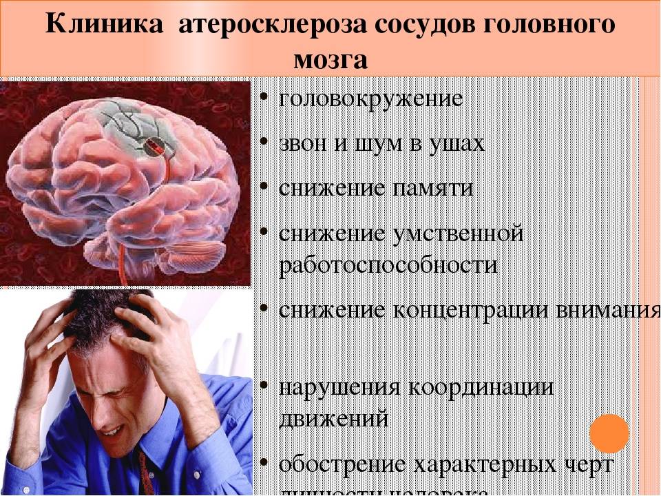 Атеросклероз сосудов головного мозга - признаки, симптомы, причины, диагностика и способы лечения заболевания
