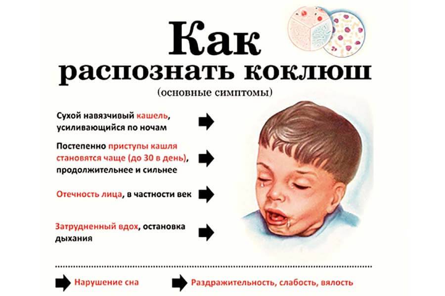 Паракоклюш симптомы у детей лечение и профилактика