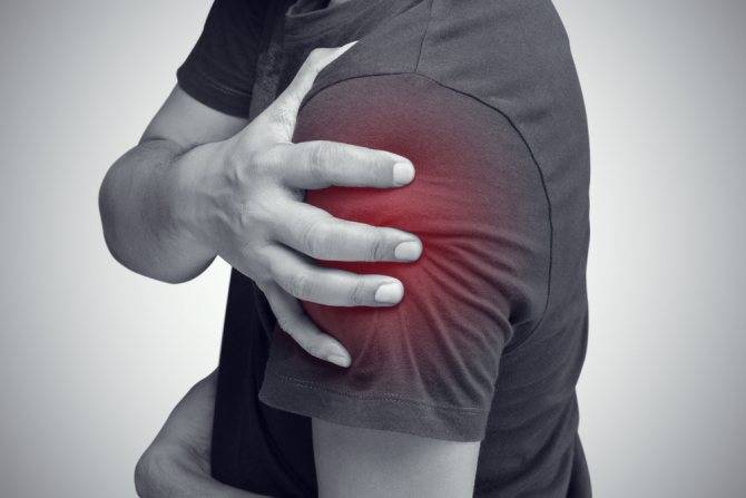 Народные средства лечения периартрита плечевого сустава