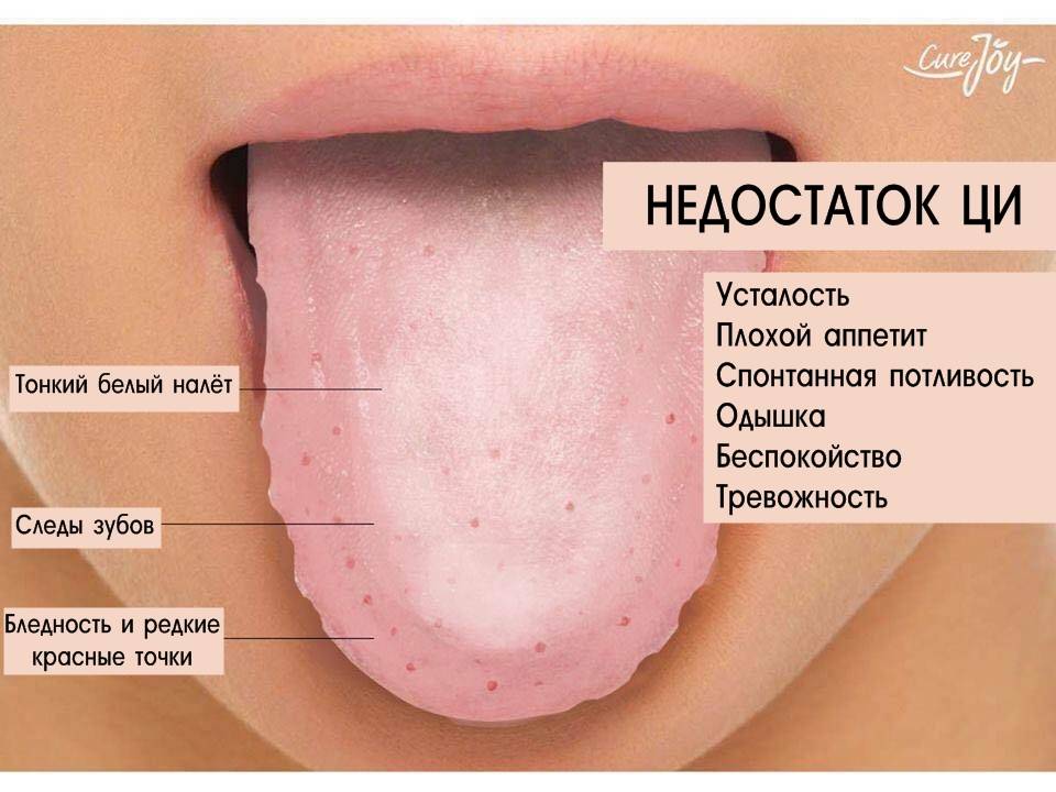 Причины жжения во рту и на поверхности языка