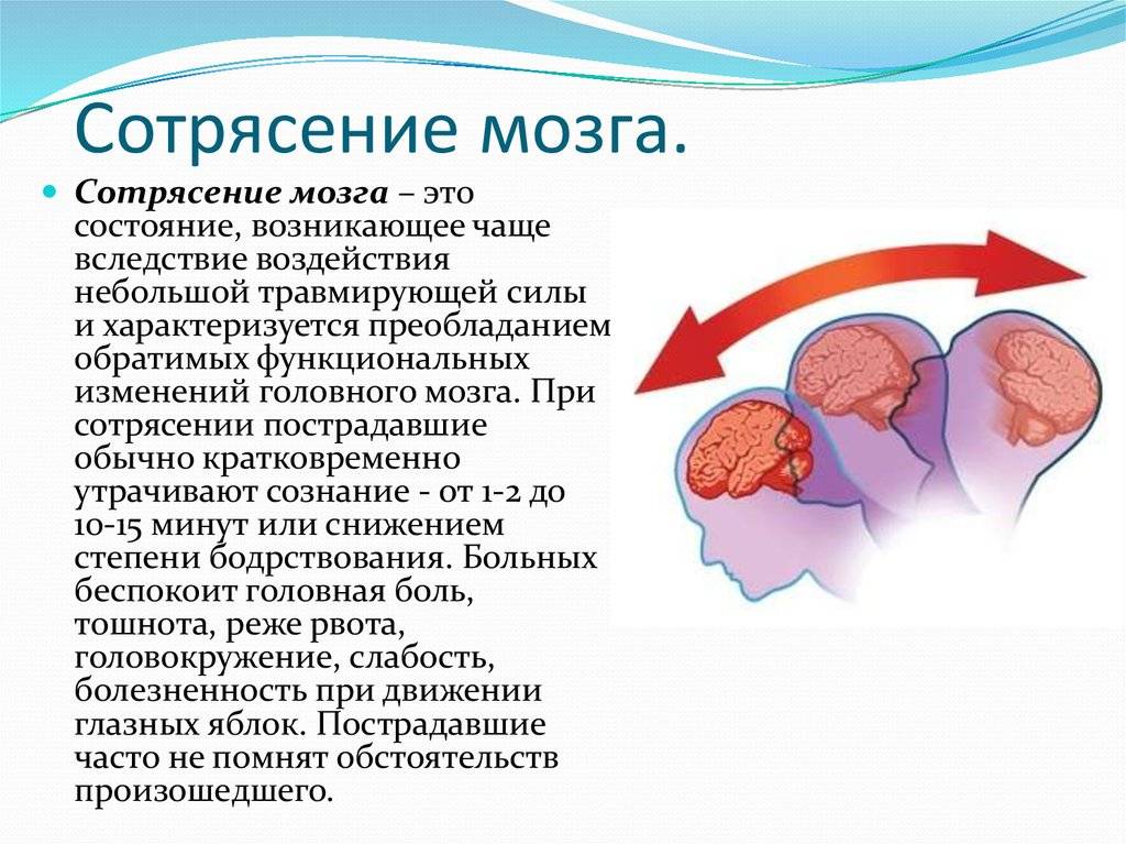 Как получить сотрясение. Сотрясение головного м. Сотрясение головного мозга симптомы.