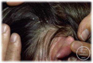 Чем лечить шелушение ушей. шелушится кожа в ухе: основные причины и методы лечения - всё об аллергии