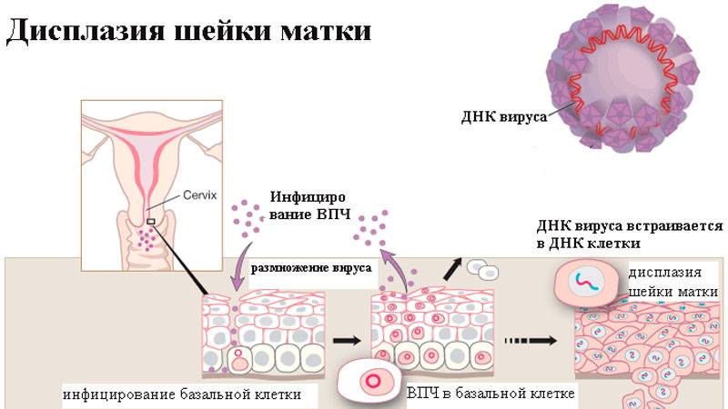 Косвенные признаки впч в цитологии: основные симптомы у женщин и у мужчин
