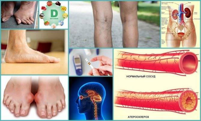 Лечение судорог ног и рук народными средствами  | рецепт здоровья