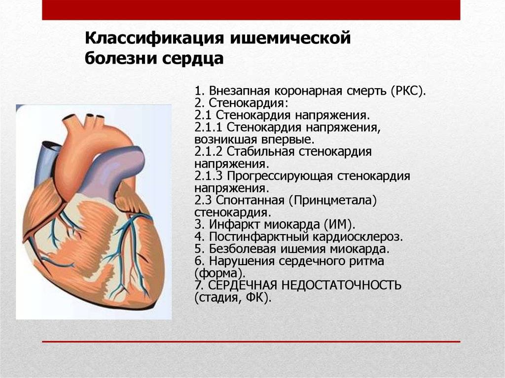 Области ишемии. Ишемическая болезнь сердца стенокардия. ИБС болезнь сердца симптомы. ИБС прогрессирующая стенокардия осложнения. Основные симптомы ишемической болезни сердца.