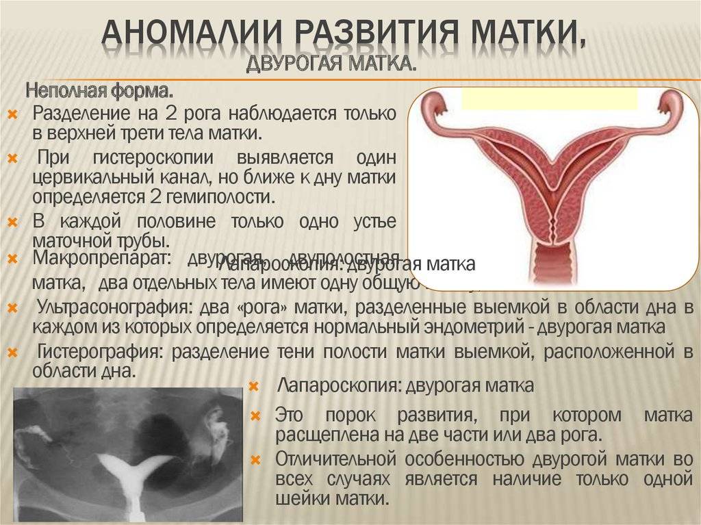 Загиб матки и беременность: шансы на зачатие, методы лечения / mama66.ru
