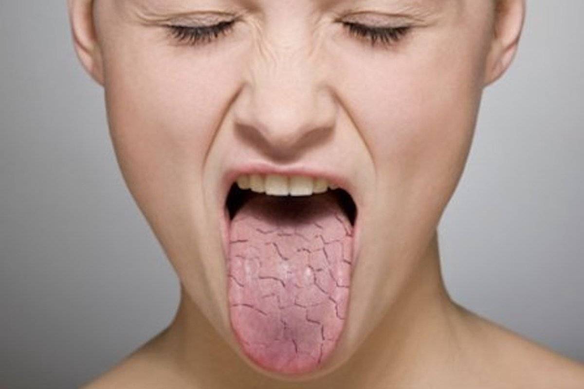 Металлический привкус во рту - признак болезни | компетентно о здоровье на ilive