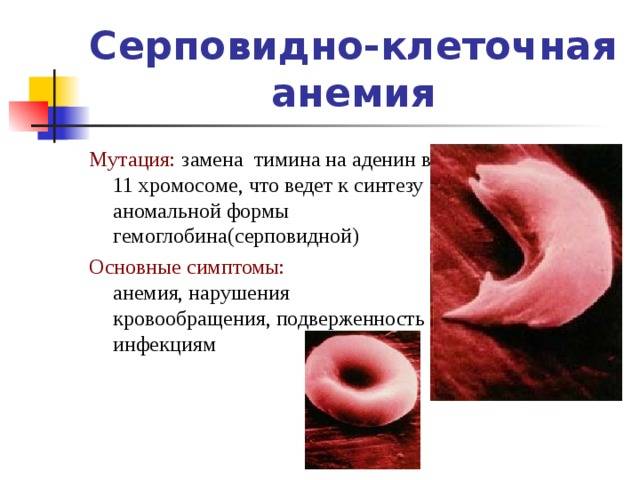 Серповидно-клеточная анемия – наследование и лечение малокровия