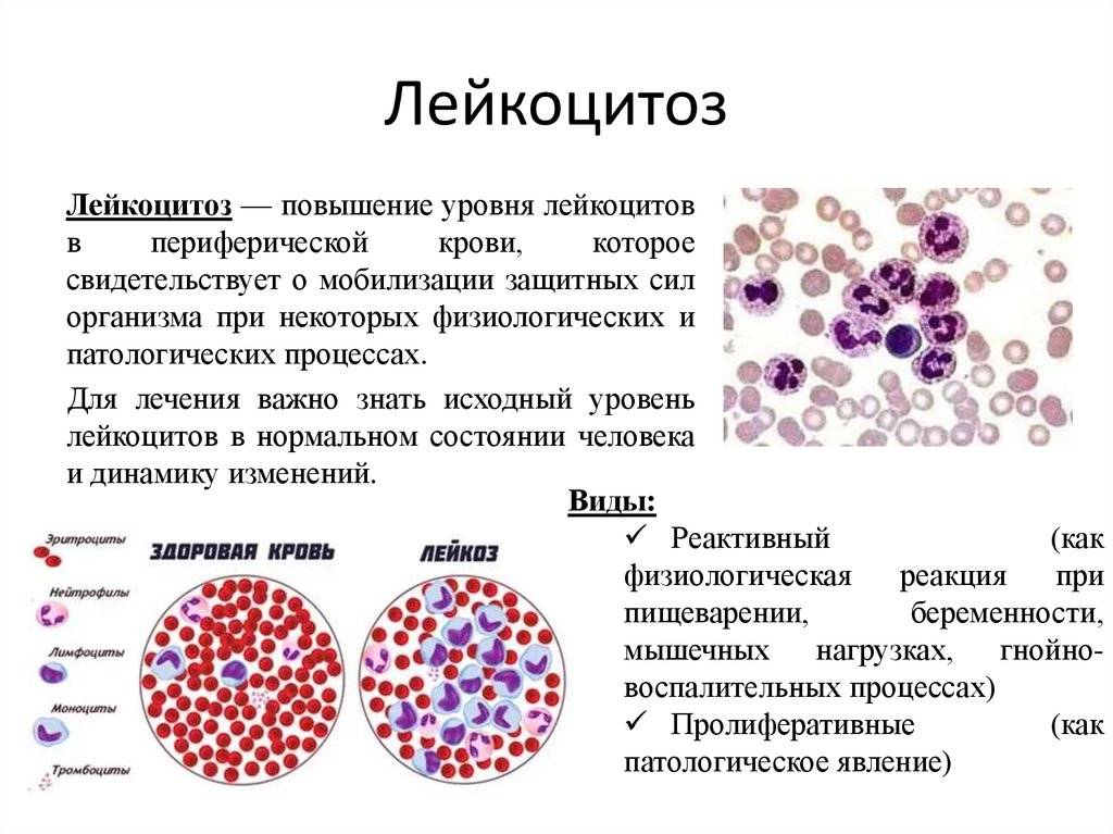 Повышенные лейкоциты в крови при беременности - беременность и роды | медицина - информационно-познавательный портал