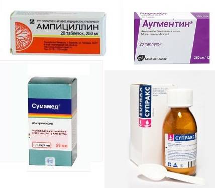 Антибиотики от бронхита: список наиболее эффективных препаратов для взрослых
