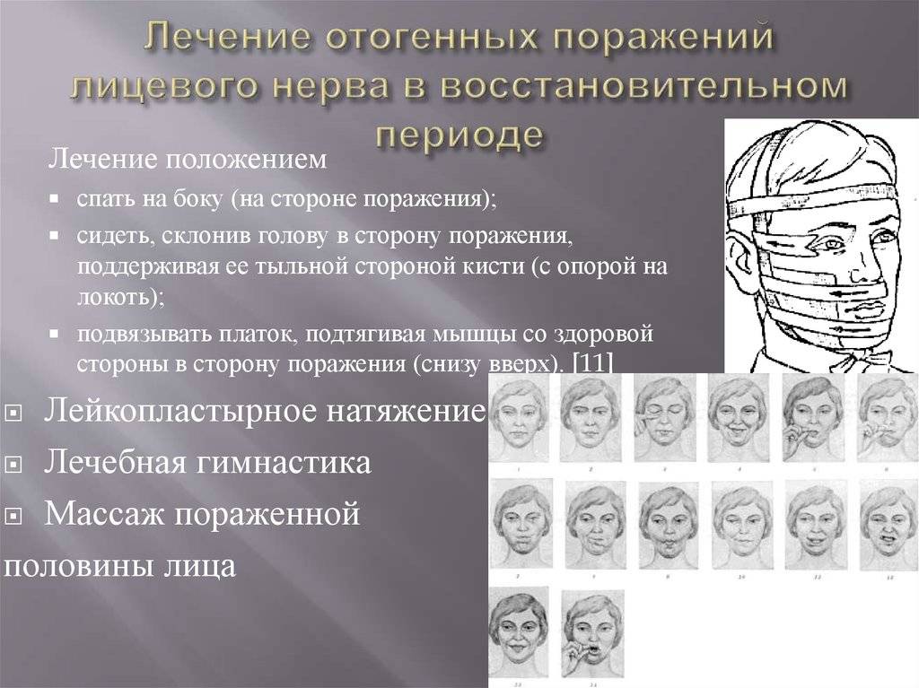 Как быстро вылечить невралгию воспаление лицевого нерва healthislife.ru - все о здоровье