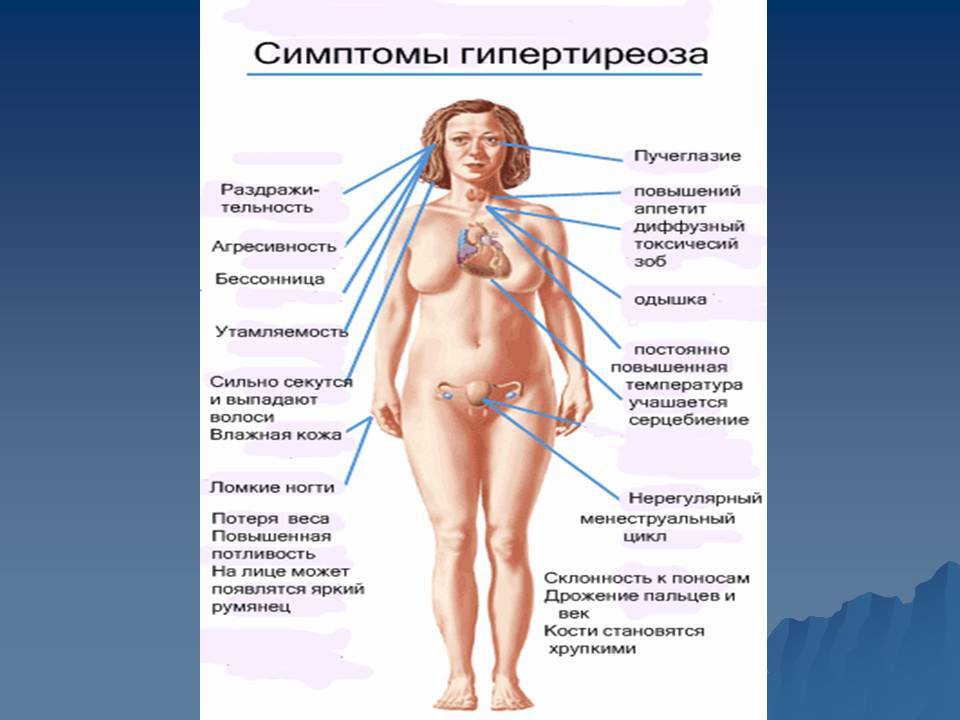 Гиперэстрогения у женщин. симптомы, причины и лечение