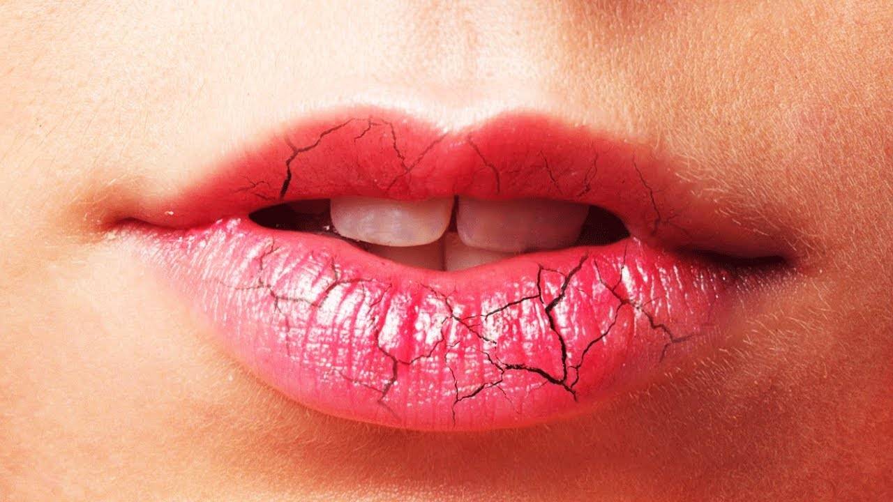 Покраснение в уголках губ: причины шелушения кожи и красноты - почему она шелушится и краснеет?