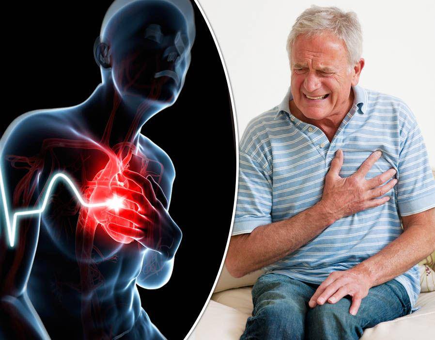Основные признаки инфаркта миокарда у женщин