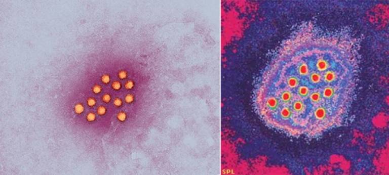 Вирусы вызывающие гепатит. Культивирование вируса гепатита а. Возбудитель гепатита а. Резистентность вируса гепатита с. Вирус гепатита в.