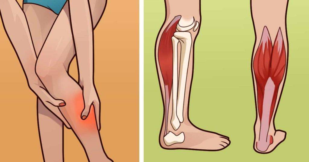 Болит икроножная мышца на правой, левой ноге, несколько дней, при ходьбе, беге, после судороги. причины, что делать