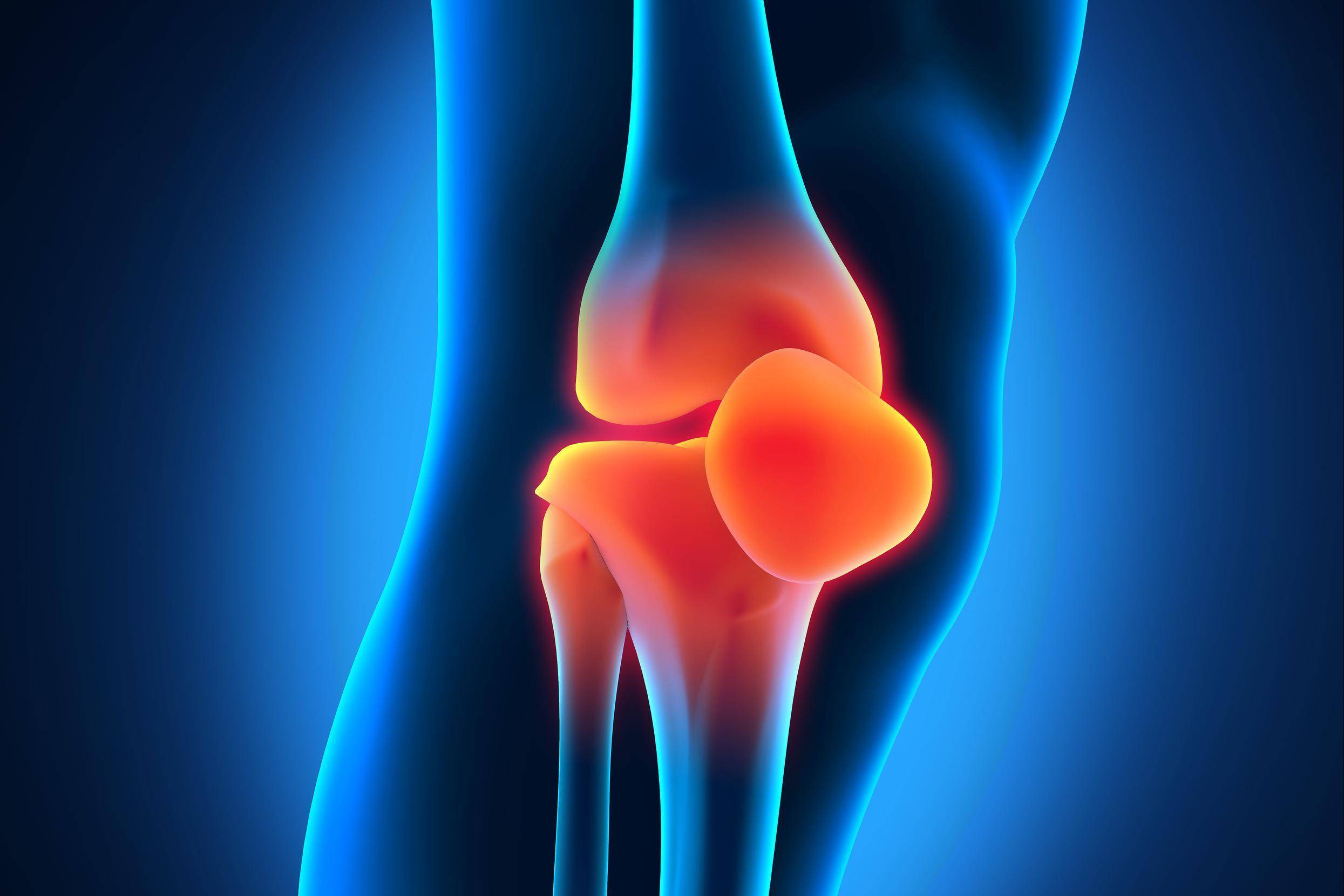 Болезнь кенига коленного сустава: лечение, операция, прогноз