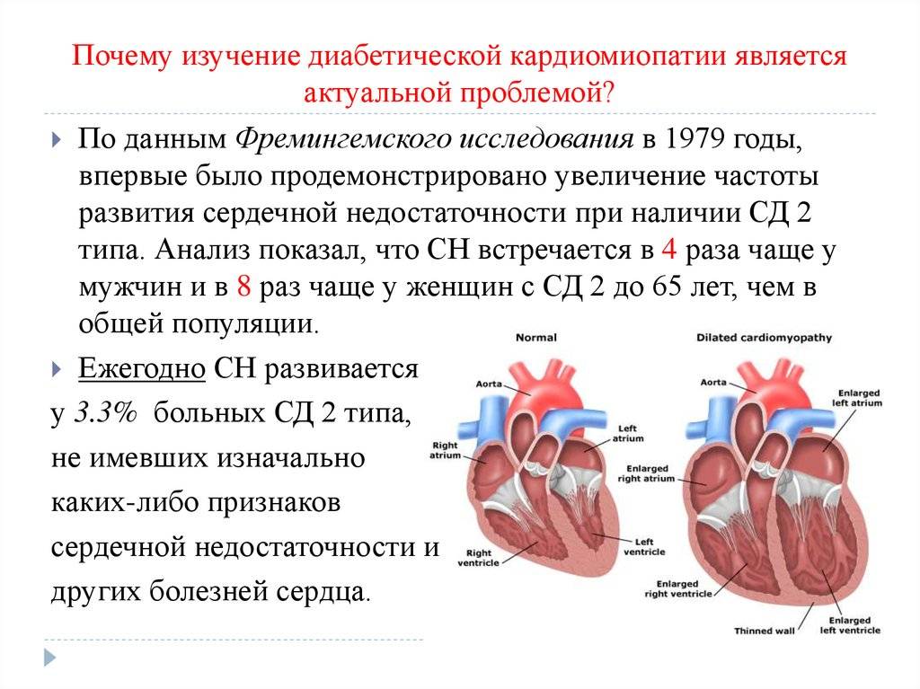 Изменения миокарда левого желудочка сердца. Кардиомиопатия вызванная внешними причинами 142.7. Дилатационная кардиомиопатия причины. Клинические симптомы кардиомиопатии. Дилатационная кардиомиопатия клинические симптомы.