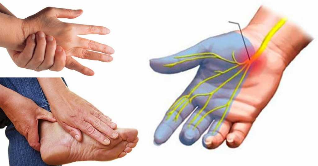 Покалывание в руках и ногах (как иголками): причины, лечение кистей и ступней