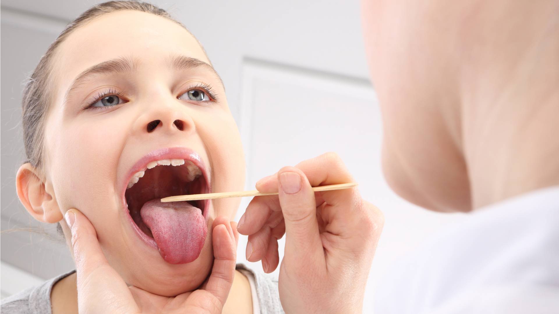 Герпес в горле у ребенка – как лечить герпесную ангину у детей? герпесная ангина у детей – симптомы, фото
