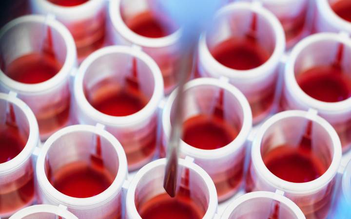 Кровь на антитела к лямблиям аскаридам