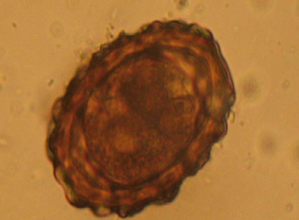 Яйцо аскариды под микроскопом