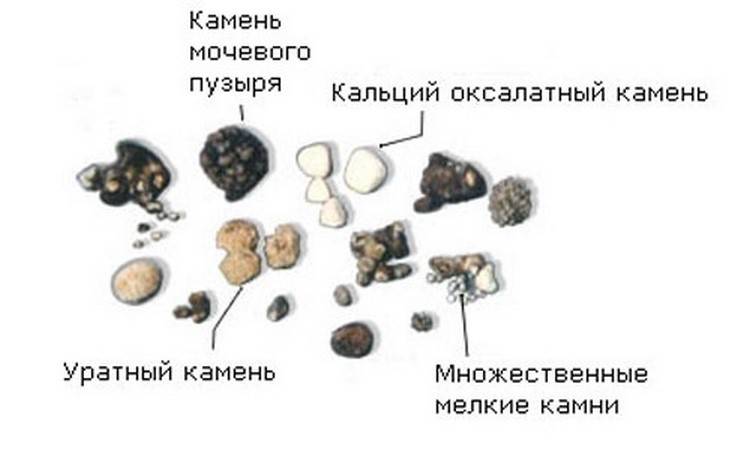 Виды почечных камней фото и названия и описание внешности