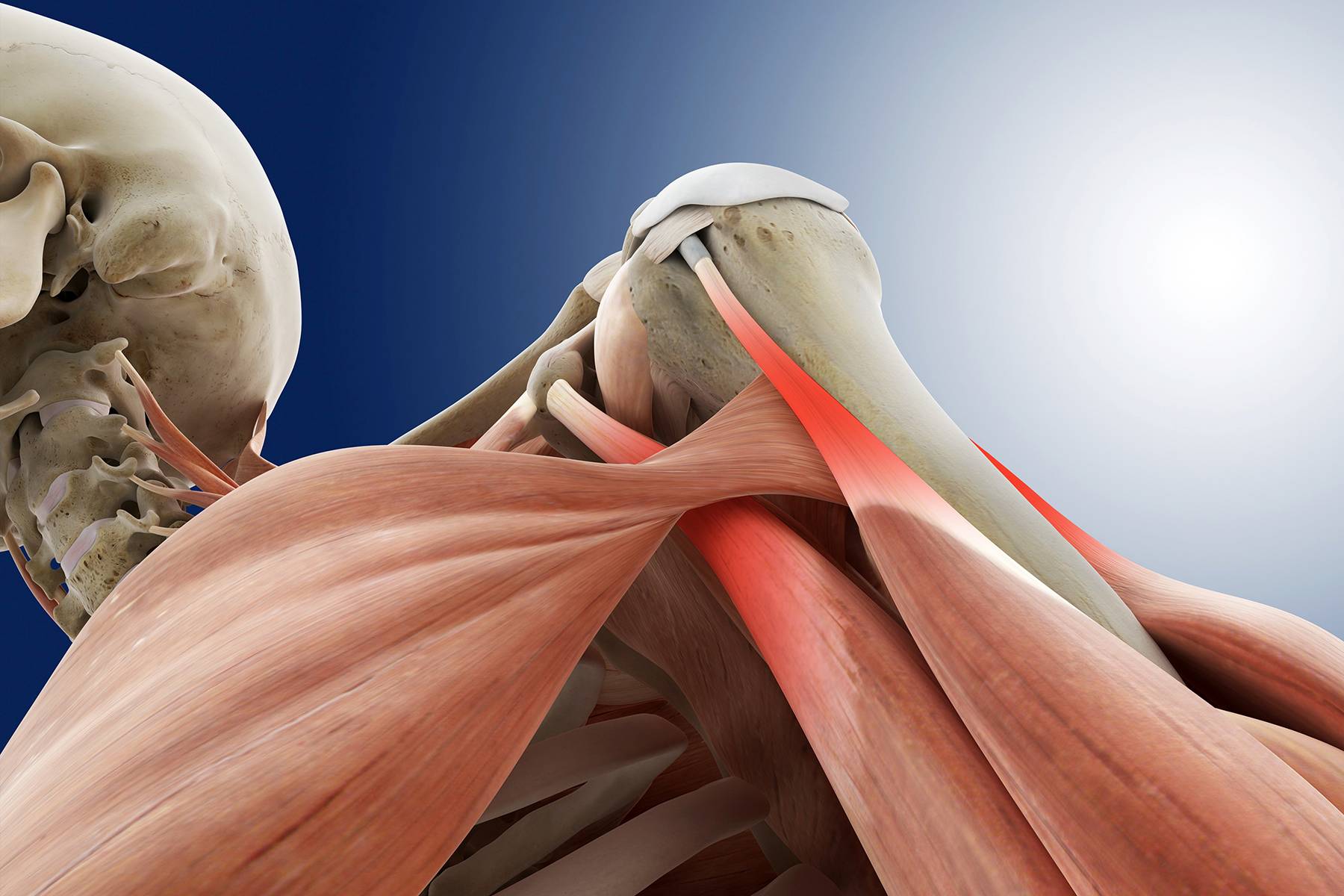 Разрыв ротаторной. Ротаторная манжета плечевого сустава мышцы. Тендинопатия сухожилия мышцы. Тендинопатия сухожилия плечевого сустава. Тендопатия сухожилия надостной мышцы.