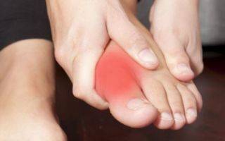 Болит сустав большого пальца ноги при ходьбе | лечение суставов