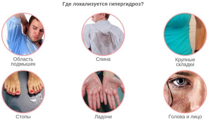 Лечение повышенной потливости рук: современные способы терапии