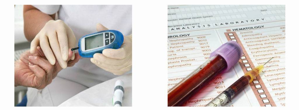 Результаты анализа крови сахар. Анализ крови на сахар. Исследование уровня Глюкозы. Исследование крови на холестерин. Анализ сахара в крови.