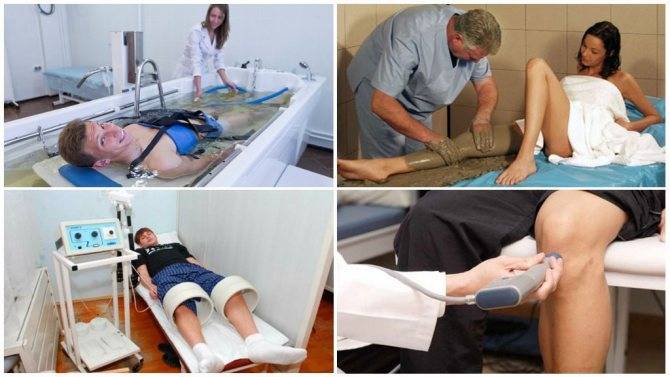 Лечение гонартроза коленного сустава 3 степени: 6 методов