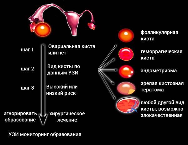 Оценка овариального резерва при поликистозе яичников