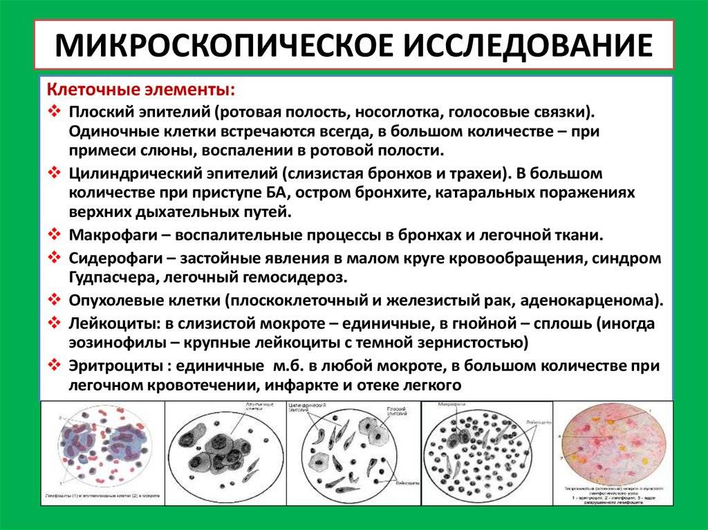 Эритроциты в простате. Исследование мокроты микроскопия норма. Клетки при микроскопии мокроты. Норма лейкоцитов в микроскопическом исследовании мокроты. Мокрота микроскопия нативного.