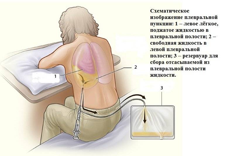 Презентация на тему пункции