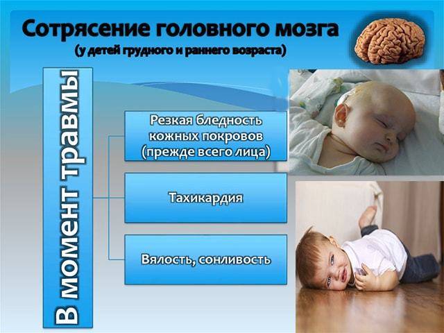 Сотрясение мозга у ребенка: симптомы и признаки, диагностика, лечение, последствия