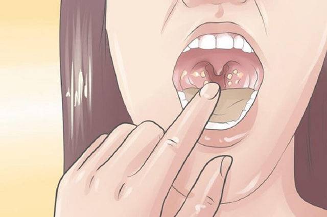 Привкус металла во рту: причины металлического вкуса, особенности у женщин и мужчин, что это означает