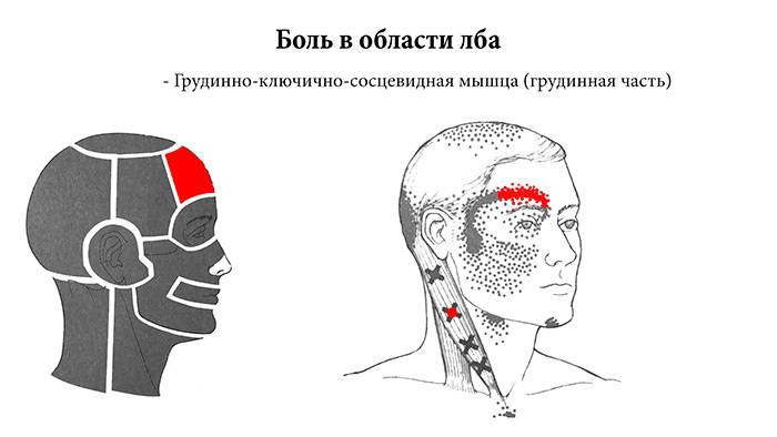 Боль в левой части затылка. Область лба. Болит левая сторона головы. Боль в левой части головы над ухом.