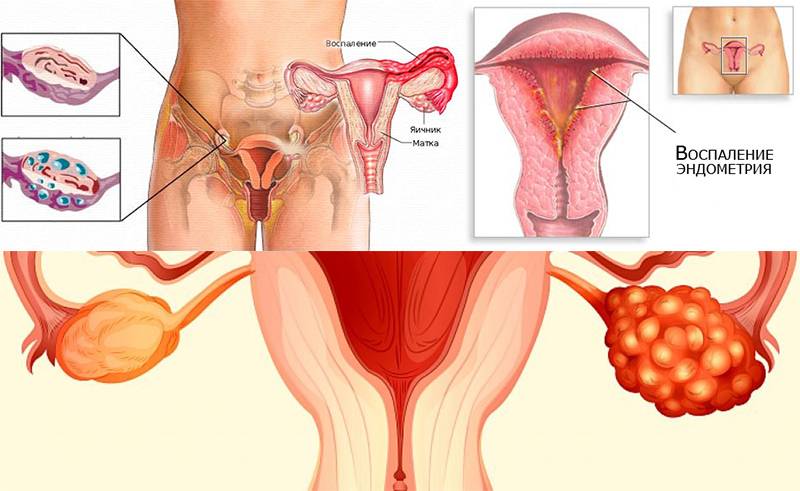 Зуд в интимной зоне у женщин: причины, симптомы, лечение