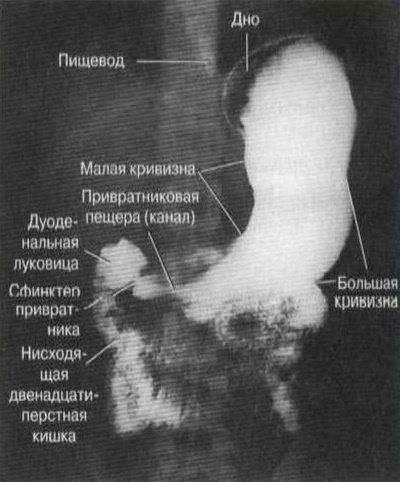 Доза облучения при рентгене желудка с барием | tsitologiya.su