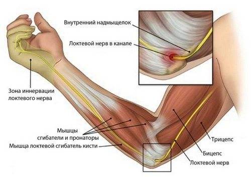 Болит рука от плеча до локтя - 9 причин, лечение, профилактика