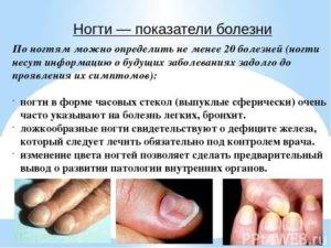 Укрепление слоящихся ногтей дома. причины и лечение проблемы.