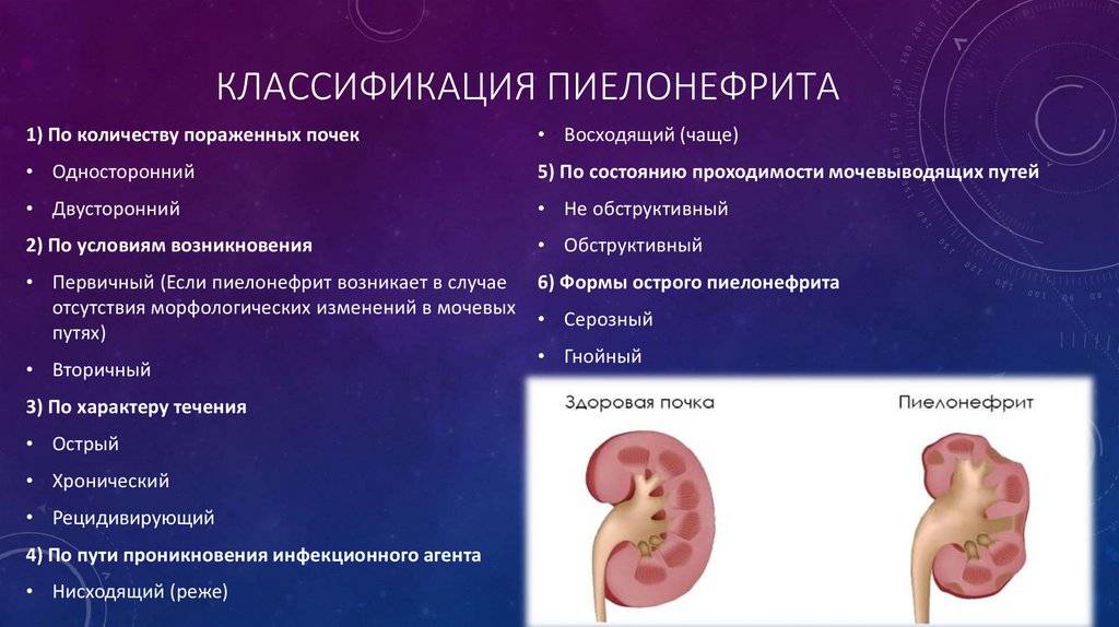 Причины возникновения пиелонефрита у беременных, симптоматика, способы диагностики и лечение