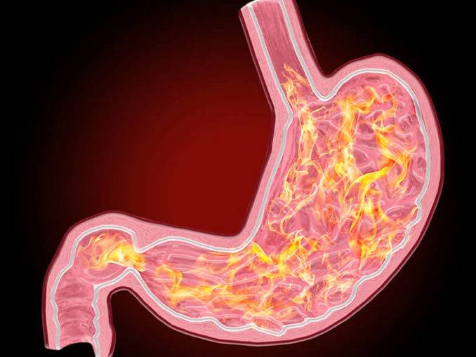 Диета и питание для больных раком желудка - как питаться, что можно кушать до и после операции - больвжелудке